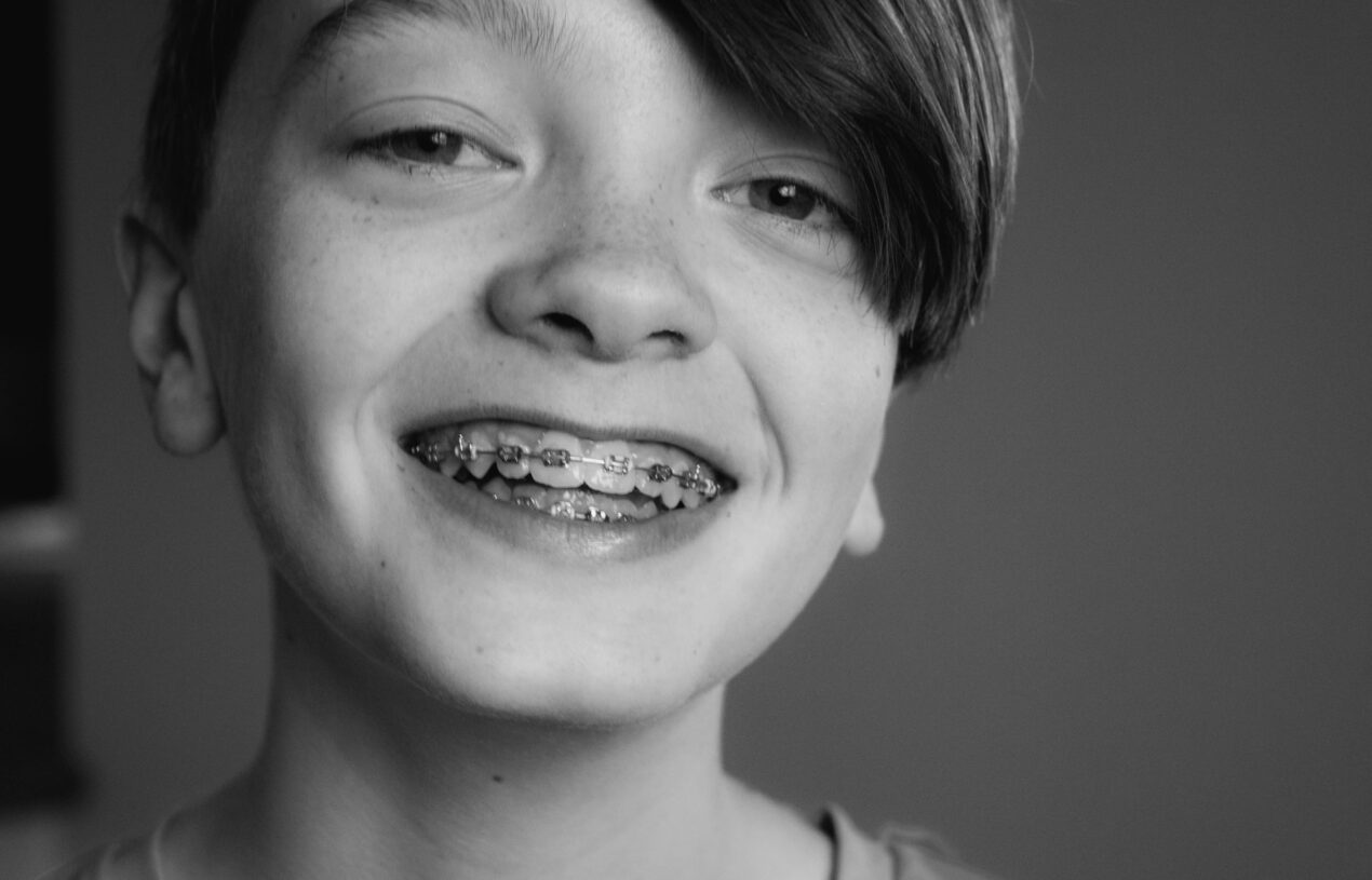 7 Tell-Tale Signs It’s Time for Braces